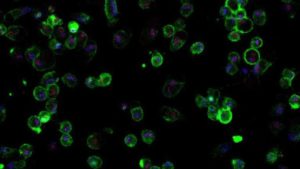 scientists measure the speed of death and solve medical mystery