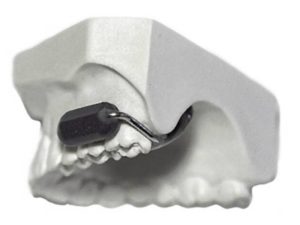 new tooth phone technology gets funding by military