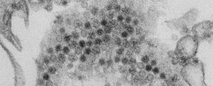 strange new type of virus discovered in Japan
