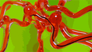 worm like robot invented that can wriggle through the brain