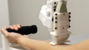 robot better at drawing blood than humans