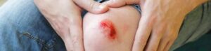 wound healing gel created from algae